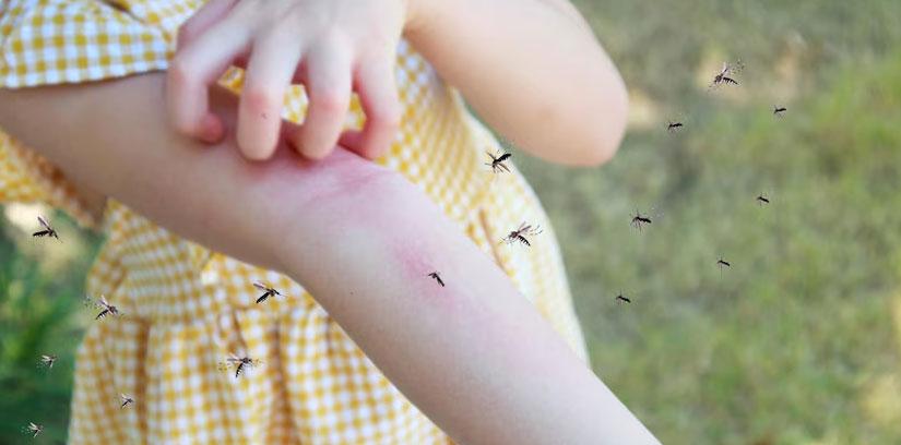 Monsoon Brings Mosquito Surge: 10 Expert-Backed Ways to Prevent Bites and Stay Safe