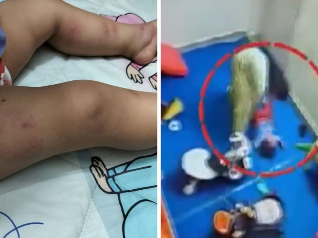 Slaps, burns, and forced confinement: Delhi daycare worker assaults toddler; staff accused of destroying CCTV evidence