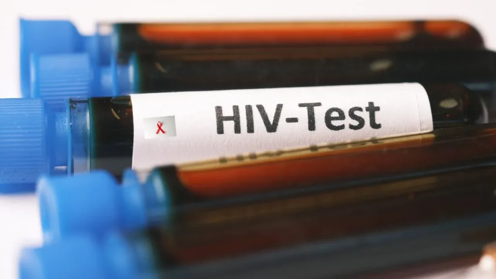 Drug-Addicted 17-Year-Old Girl Allegedly Spreads HIV to 19 Men in Nainital – Case Reignites Concern Over Youth Addiction & Health Awareness
