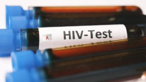 Drug-Addicted 17-Year-Old Girl Allegedly Spreads HIV to 19 Men in Nainital – Case Reignites Concern Over Youth Addiction & Health Awareness