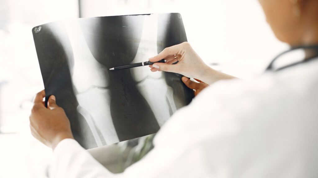 National Bone and Joint Day: 6 Things Your Joints Need Today, Not Tomorrow