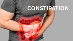 Understanding Constipation and Its Treatment