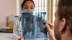 World Lung Cancer Day 2025: Why Lung Cancer Is No Longer Just a Smoker’s Disease