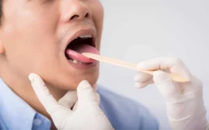 Why Men Over 40 Are More Prone to Tongue Cancer; Here’s Everything To Know About Warning Signs and Prevention
