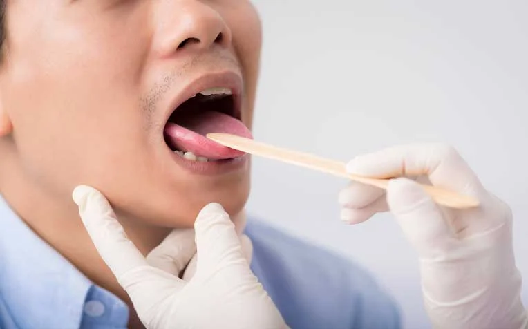 Why Men Over 40 Are More Prone to Tongue Cancer; Here’s Everything To Know About Warning Signs and Prevention