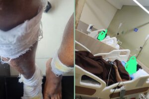 Pune: Bike Accidents Rise In Maan And Bhumkar Chowk Due To Poor Road Conditions