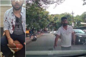 Pune: Car Driver Assaulted In Khadki After Stopping Wrong-Side Biker; CCTV Video Sparks Outrage