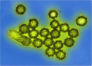H3N2 Flu Cases on the Rise: Symptoms, Prevention, and When to See a Doctor