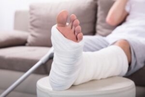 7 Simple Habits That Can Save Your Bones From Painful Fractures