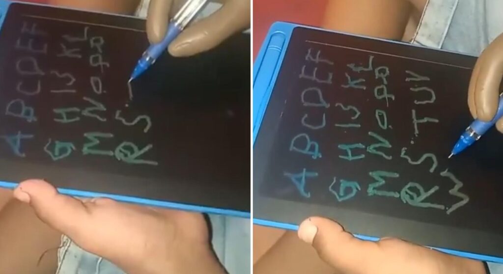 8-Year-Old Pune Boy Who Lost Hand to GBS Returns to School With Prosthetic Arm, Emotional Video Surfaces