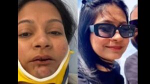 Indian-Origin Couple Brutally Assaulted at Swiss Hotel; Woman Suffers Severe Dental Injuries