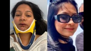 Indian-Origin Couple Brutally Assaulted at Swiss Hotel; Woman Suffers Severe Dental Injuries