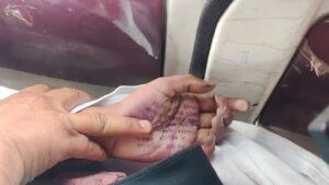 Maharashtra: Satara Woman Doctor Dies By Suicide, Names Police Officer In Note Alleging Rape And Harassment