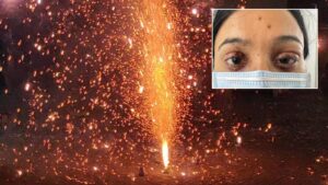 Engineering Student in Pune Suffers Eye Burns in Firecracker Accident During Diwali Celebrations