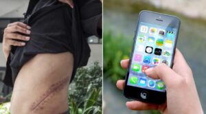 Harrowing Story: At 17, He Sold a Kidney to buy iPhone; Today, He Is Permanently Disabled