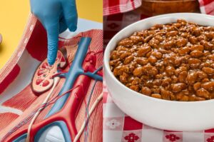 Myth or Fact: Are Kidney Beans a Natural Cure for Kidney Problems?