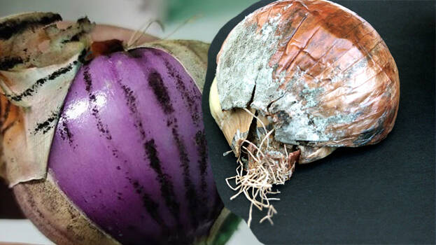 Are Black Spots on Onions Safe to Eat? Bengaluru Nutritionist Explains When to Throw Them Away