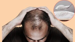 A Spoonful of Sweetness for Your Scalp? Scientists Discover Stevia’s Surprising Role in Boosting Hair Growth Treatments
