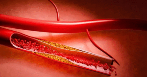 Arteries Constrict In Winter And Raise Heart Risks: What Really Happens And How To Stay Safe