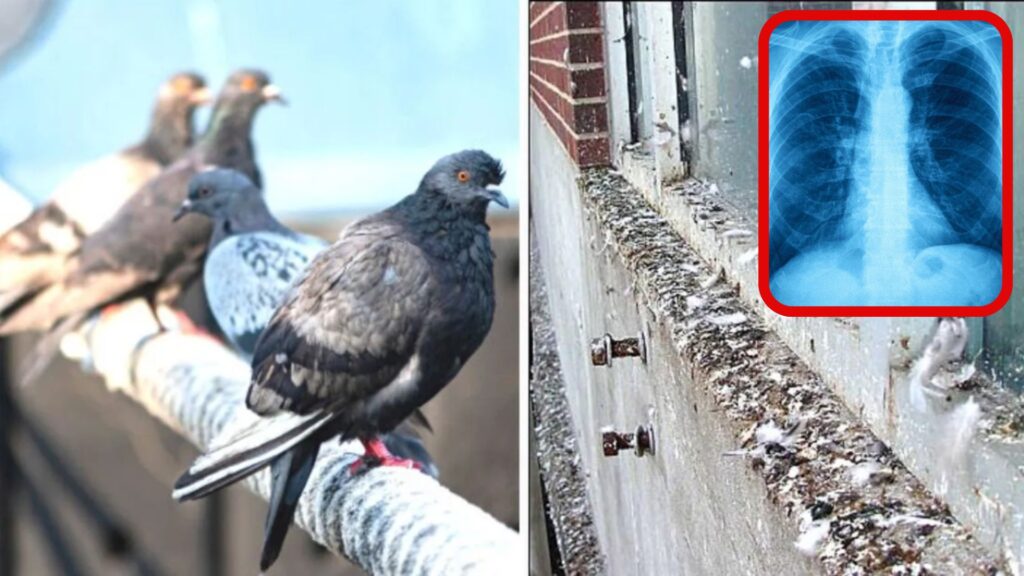 The Pigeons You Feed Could Be Silently Destroying Your Lungs