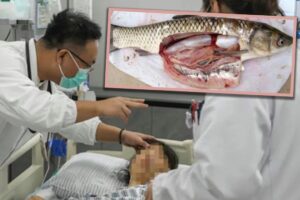 Chinese Woman’s Folk Remedy Goes Wrong After Swallowing Raw Fish Gallbladder, Ends Up in ICU
