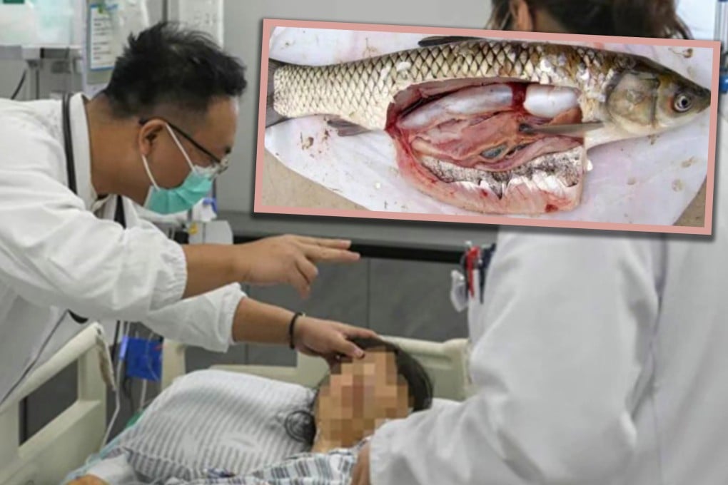 Chinese Woman’s Folk Remedy Goes Wrong After Swallowing Raw Fish Gallbladder, Ends Up in ICU