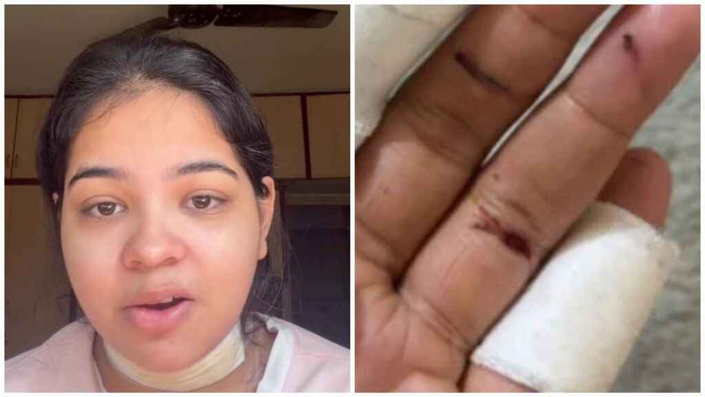 ‘I Was Fighting for My Life’: Sharp Kite ‘Manjha’ Injures Pune Woman Ahead of Makar Sankranti, Viral Video Sparks Outrage