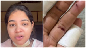 ‘I Was Fighting for My Life’: Sharp Kite ‘Manjha’ Injures Pune Woman Ahead of Makar Sankranti, Viral Video Sparks Outrage
