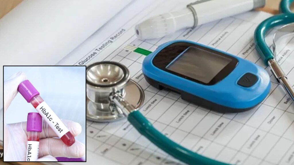 India’s Over-Reliance On HbA1c Test May Delay Diabetes Diagnosis By Years: Study Warns