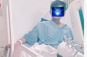 Pune: FITE Seeks Urgent Government Intervention As Minor Accident Victim’s Surgery Delayed Over Lack Of Funds