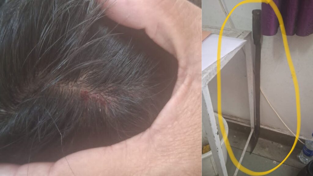 Pune: HSC Candidate Injured In Machete Attack Outside Kothrud Exam Centre