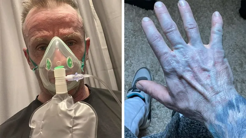 UK Man Wakes Up With Blue Skin, The Real Cause Leaves Doctors Amused