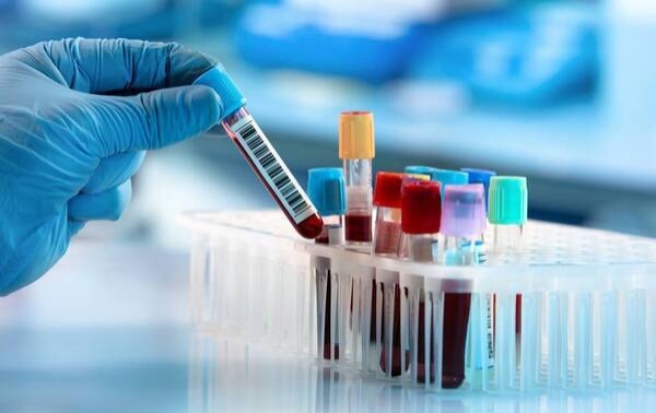 This simple blood test could detect hidden heart failure earlier in diabetes patients
