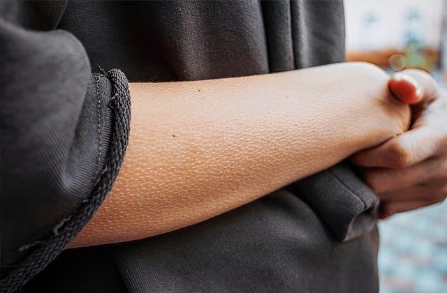Oops Goosebumps Again! Why They Appear And Disappear On Your Skin