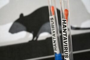 Hantavirus Symptoms Often Look Like Flu at First, But the Infection Can Rapidly Damage Kidneys and Lungs