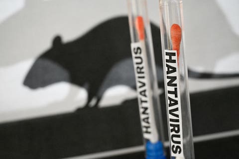 Hantavirus Symptoms Often Look Like Flu at First, But the Infection Can Rapidly Damage Kidneys and Lungs