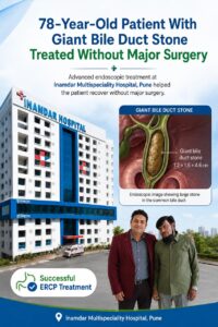 78-Year-Old Patient With Giant Bile Duct Stone Treated Without Major Surgery at Inamdar Hospital