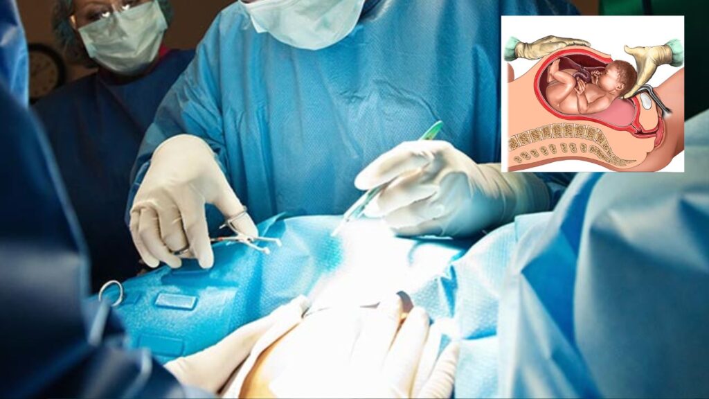 Pune: Family Files Medical Negligence Complaint After Newborn Dies Following Delayed C-Section at Wagholi Hospital