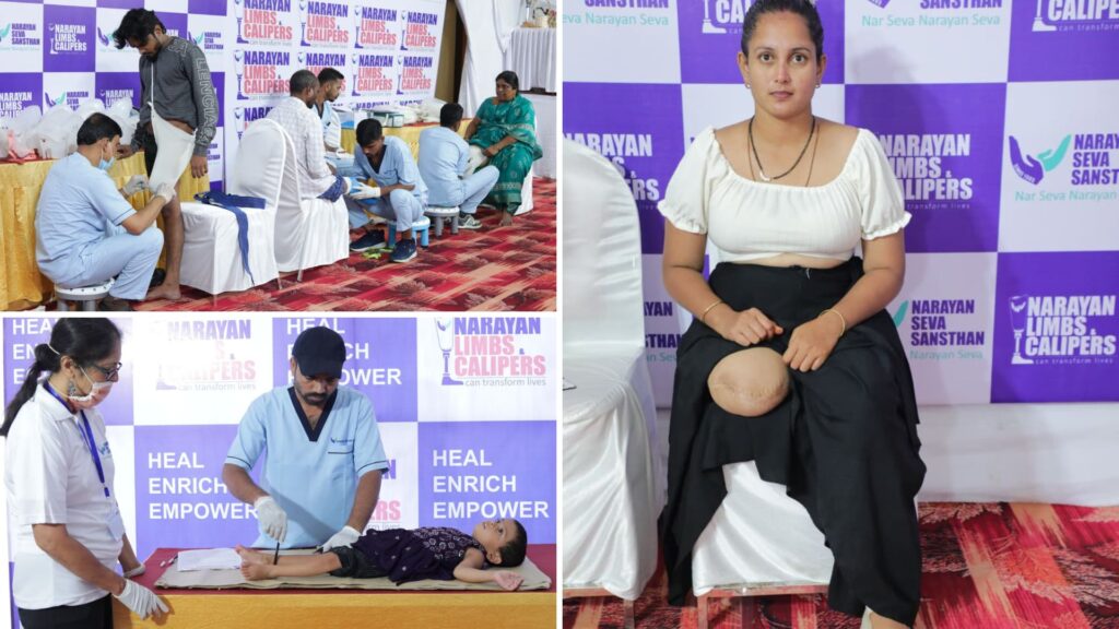  Pune: Over 396 Persons With Disabilities Benefit From Narayan Seva Sansthan's Mega Camp  